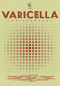 VARICELLA - 2015 